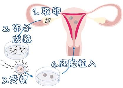 生殖医学科
